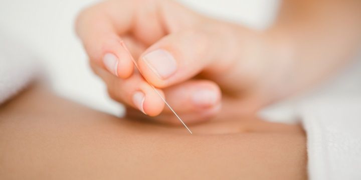5 Greatest Tips for People Suffering from Back Pain Try acupuncture